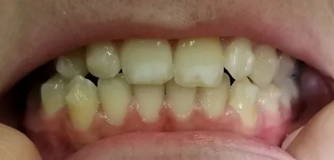 Smile gallery image 4